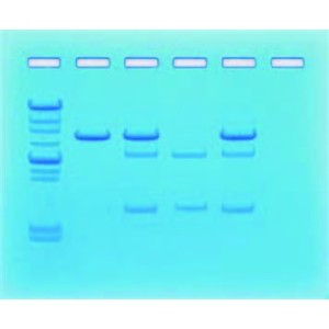 Family pedigree cancer gene detection